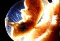 Seminario: Aborto ¿desarrollo o subdesarrollo? embrion
